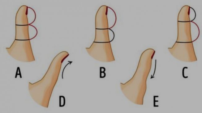 Tes Psikologi: Bentuk Jempol Mana Paling Mirip, Ungkap Ciri-ciri Kepribadian Anda yang Jarang Disadari, Cek di Sini!