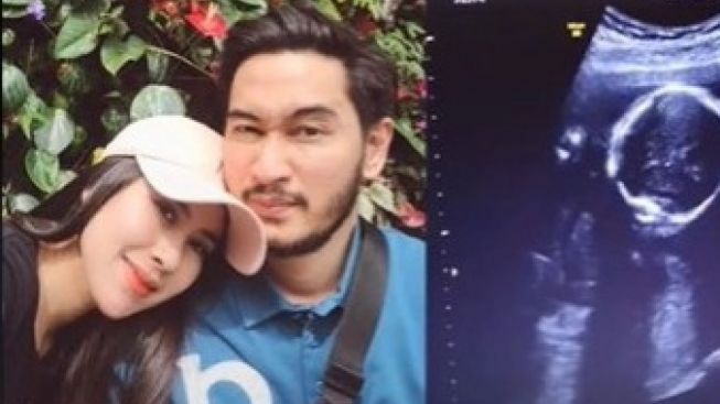 Mengejutkan, Akun Ini Bongkar Syahnaz Sadiqah Hamil 1 Bulan, Netizen: Anak Campuran