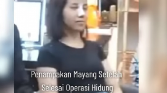 Demi Berbakti, Mayang Lucyana rela Operasi Hidung