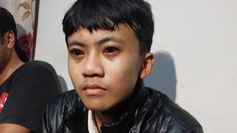 Tragedi Kanjuruhan Mata Raffi Atha Dziaulhamdi Alami Iritasi Akibat Gas Air Mata