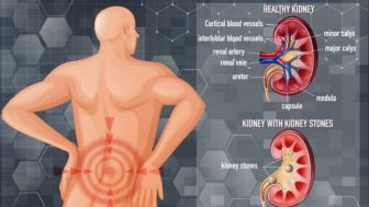 Kenal Lebih Dekat Penyakit Ginjal, Simak Penjelasan Ilmiahnya