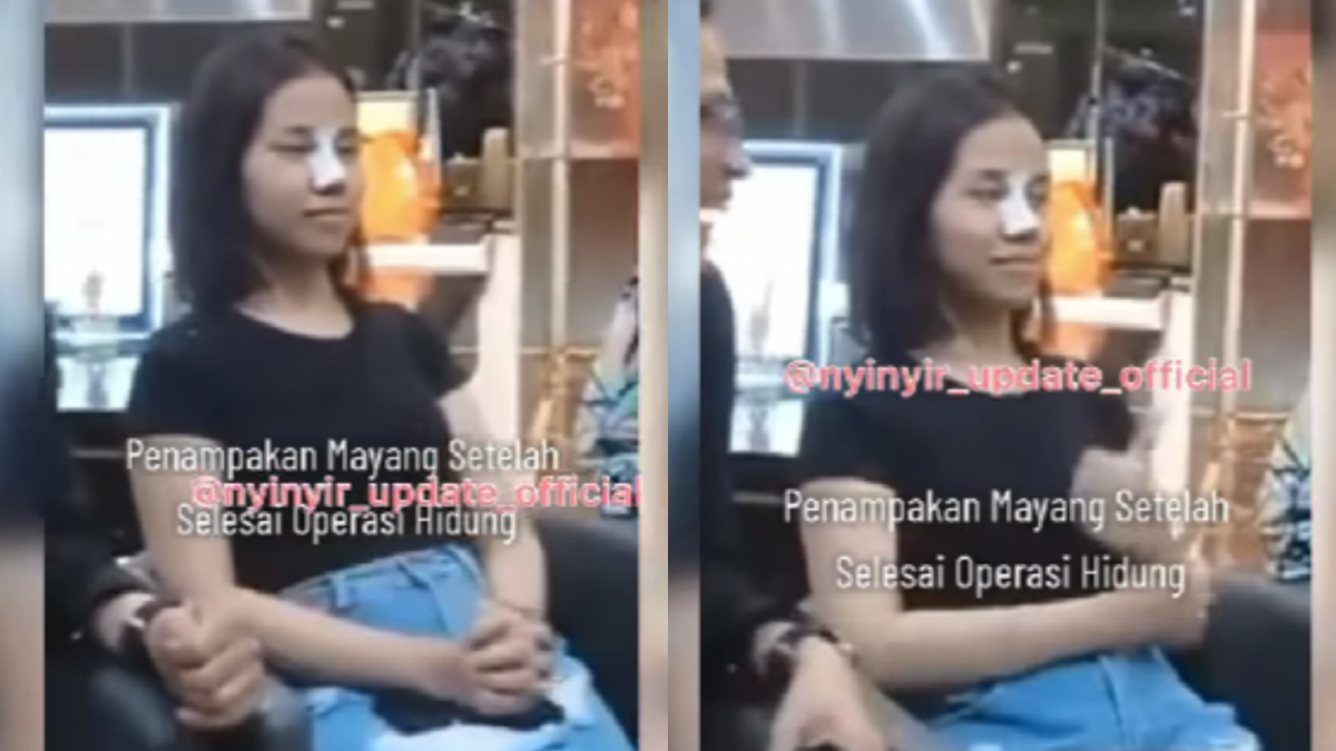 Potret adik Vanessa Angel yang baru selesai operasi hidung. [Instagram/insta_julid]